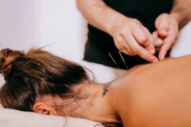 Needling at Langley Sports and Rehab.