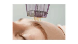 IMS Therapy in Langley