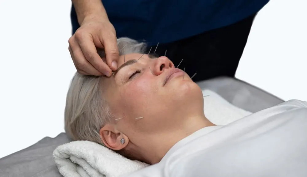 Intramuscular Stimulation